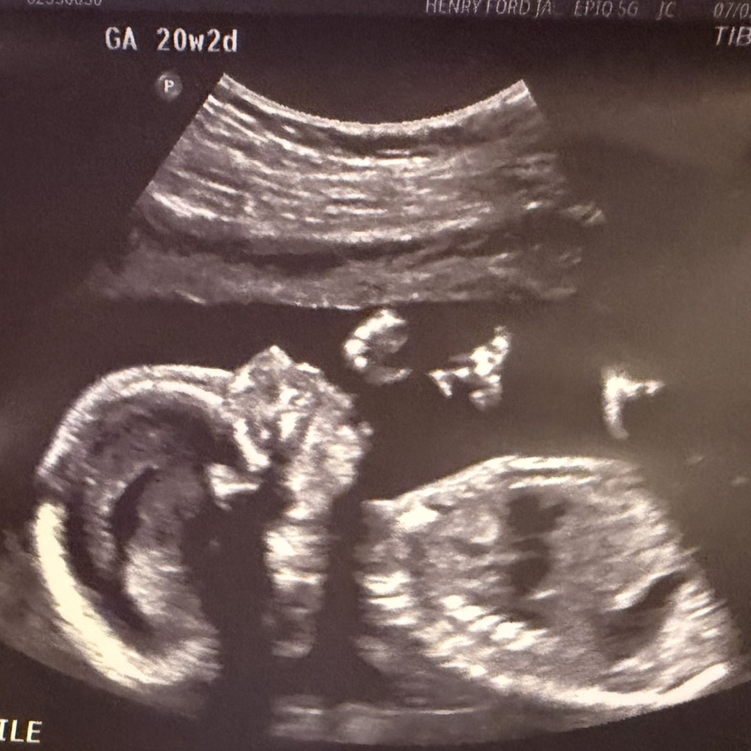 Photo shared by Shelby for their Babylist baby registry.