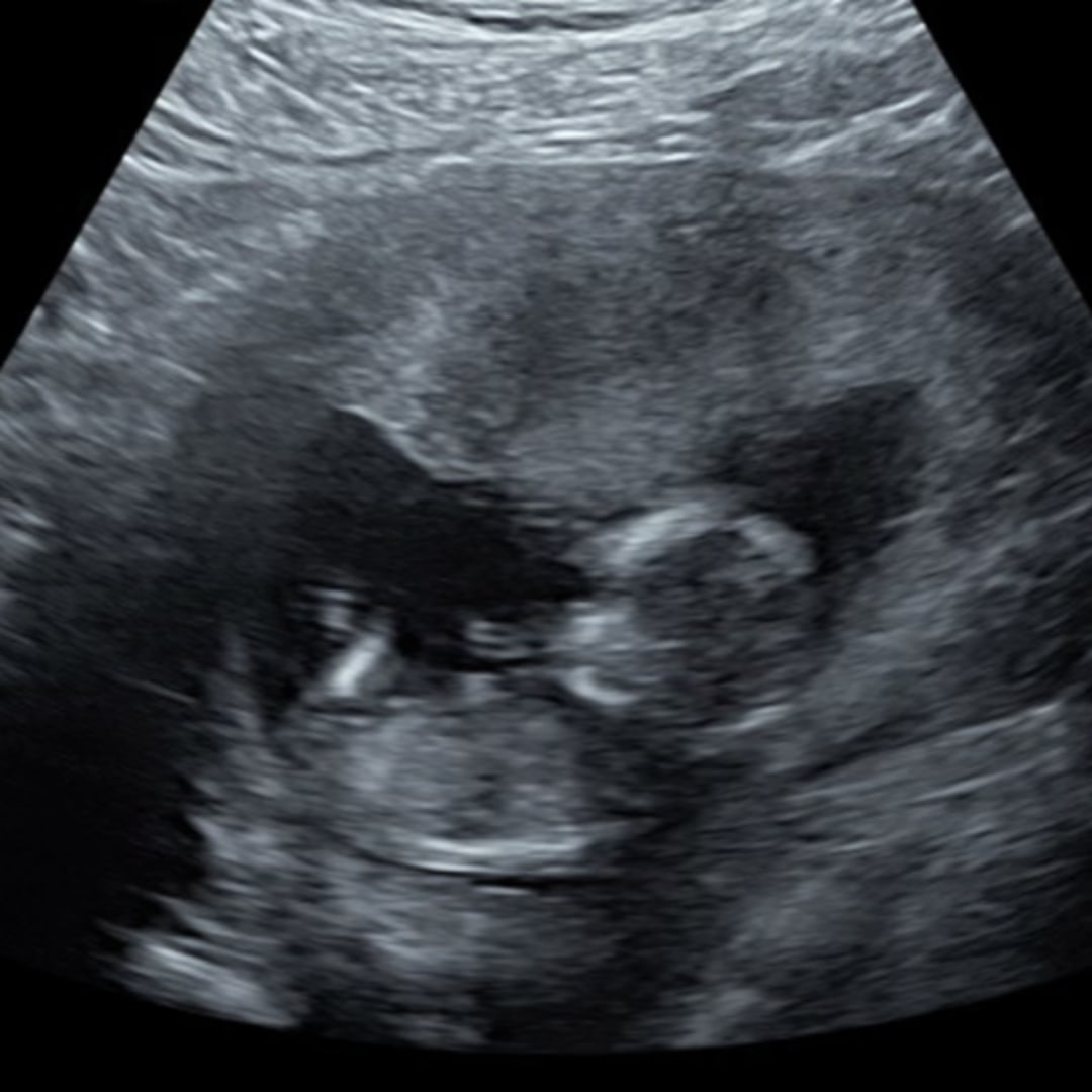 Photo shared by Marissa for their Babylist baby registry.