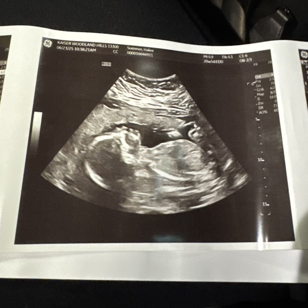 Photo shared by Halee for their Babylist baby registry.