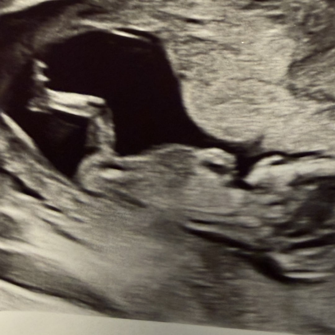 Photo shared by Ericka for their Babylist baby registry.