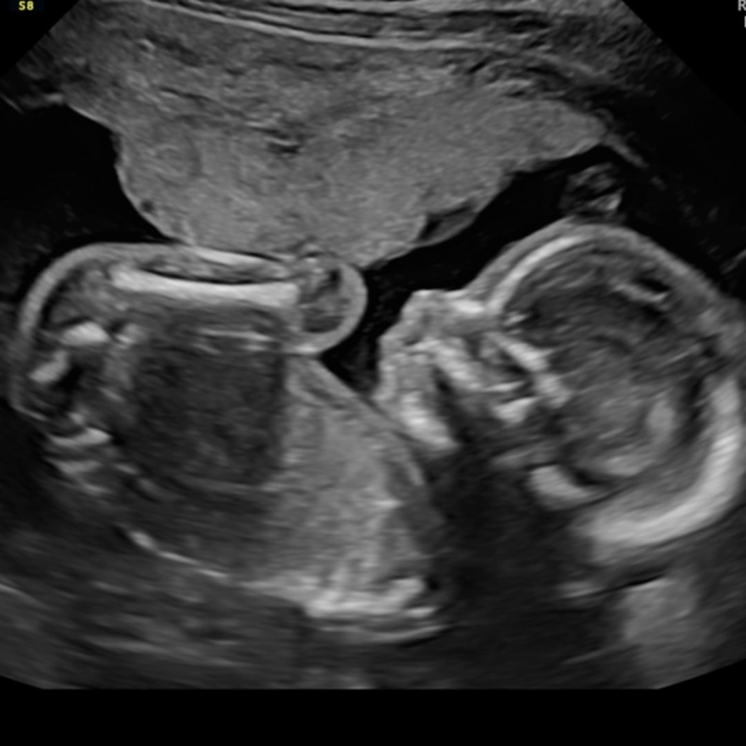 Photo shared by Kimberly for their Babylist baby registry.