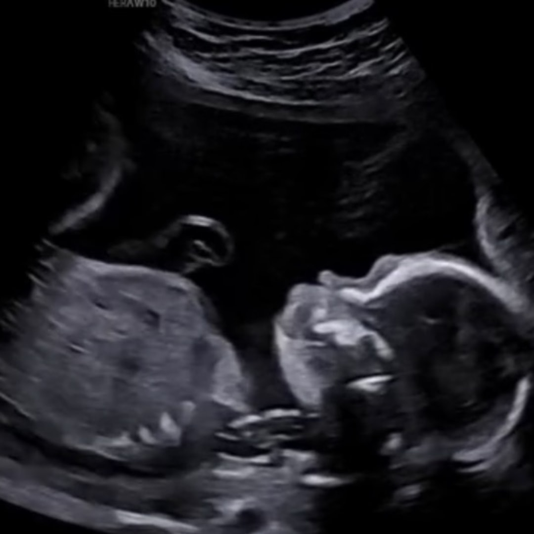 Photo shared by Chloe for their Babylist baby registry.