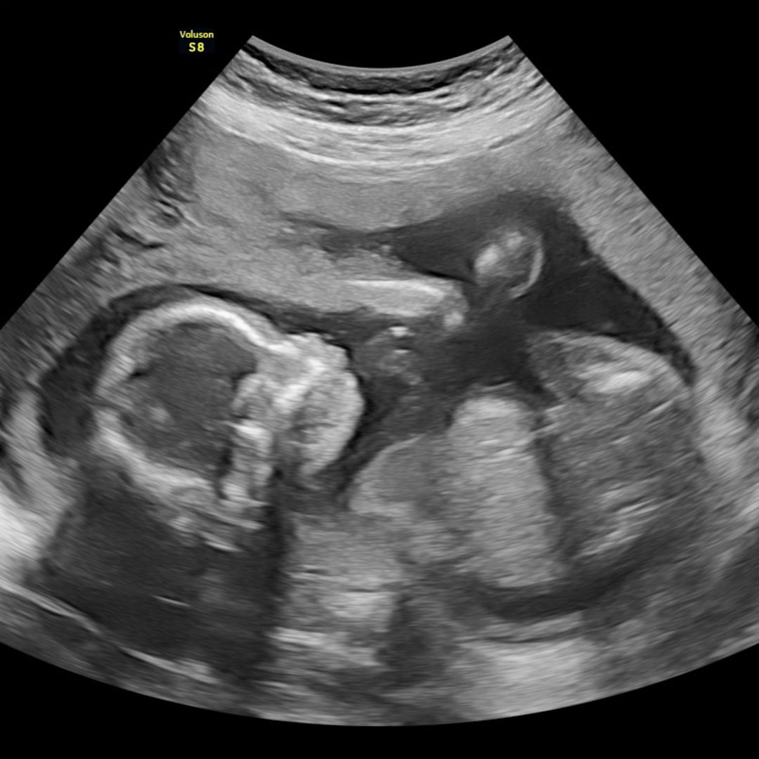 Photo shared by Codi for their Babylist baby registry.