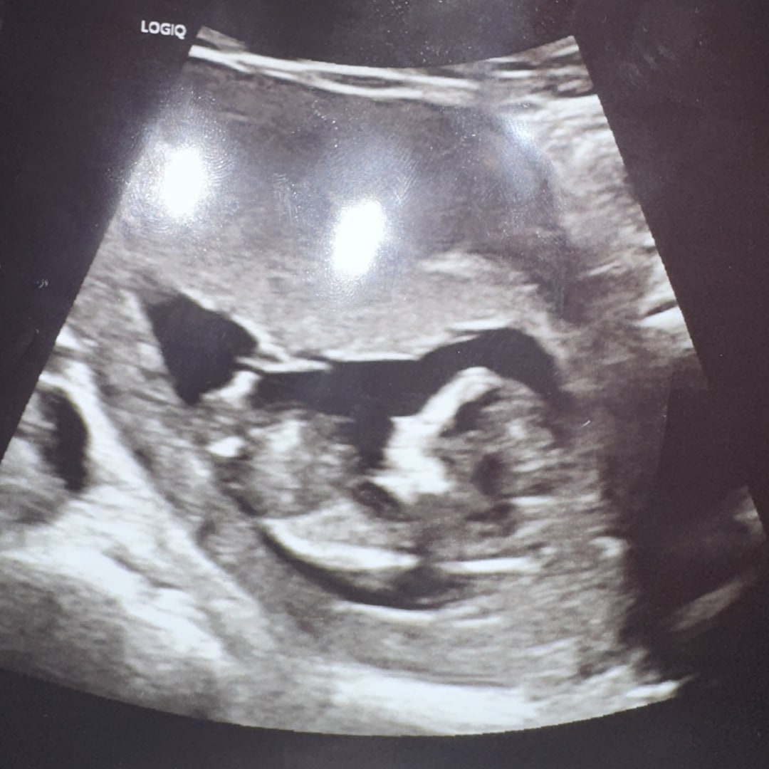 Photo shared by Asaunti for their Babylist baby registry.