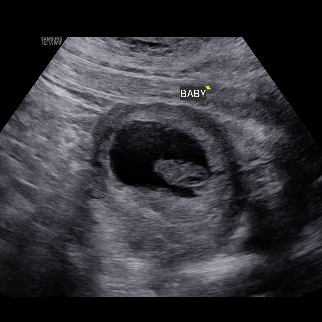 Photo shared by Jacqueline for their Babylist baby registry.