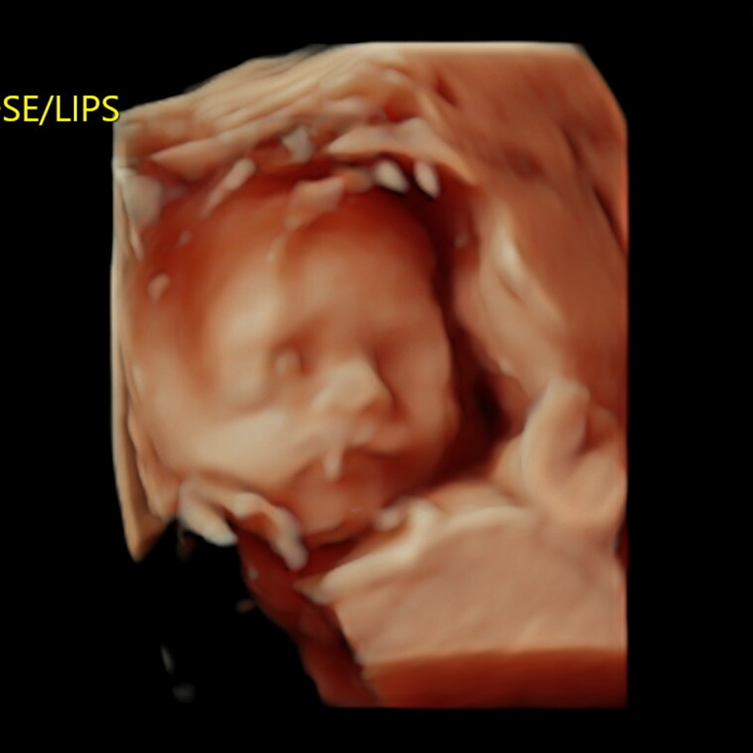 Photo shared by Grace for their Babylist baby registry.