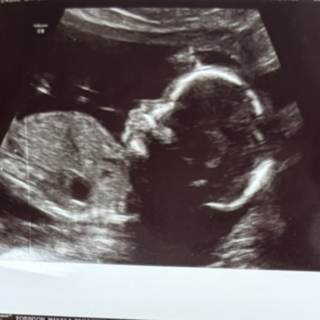 Photo shared by Makaila for their Babylist baby registry.