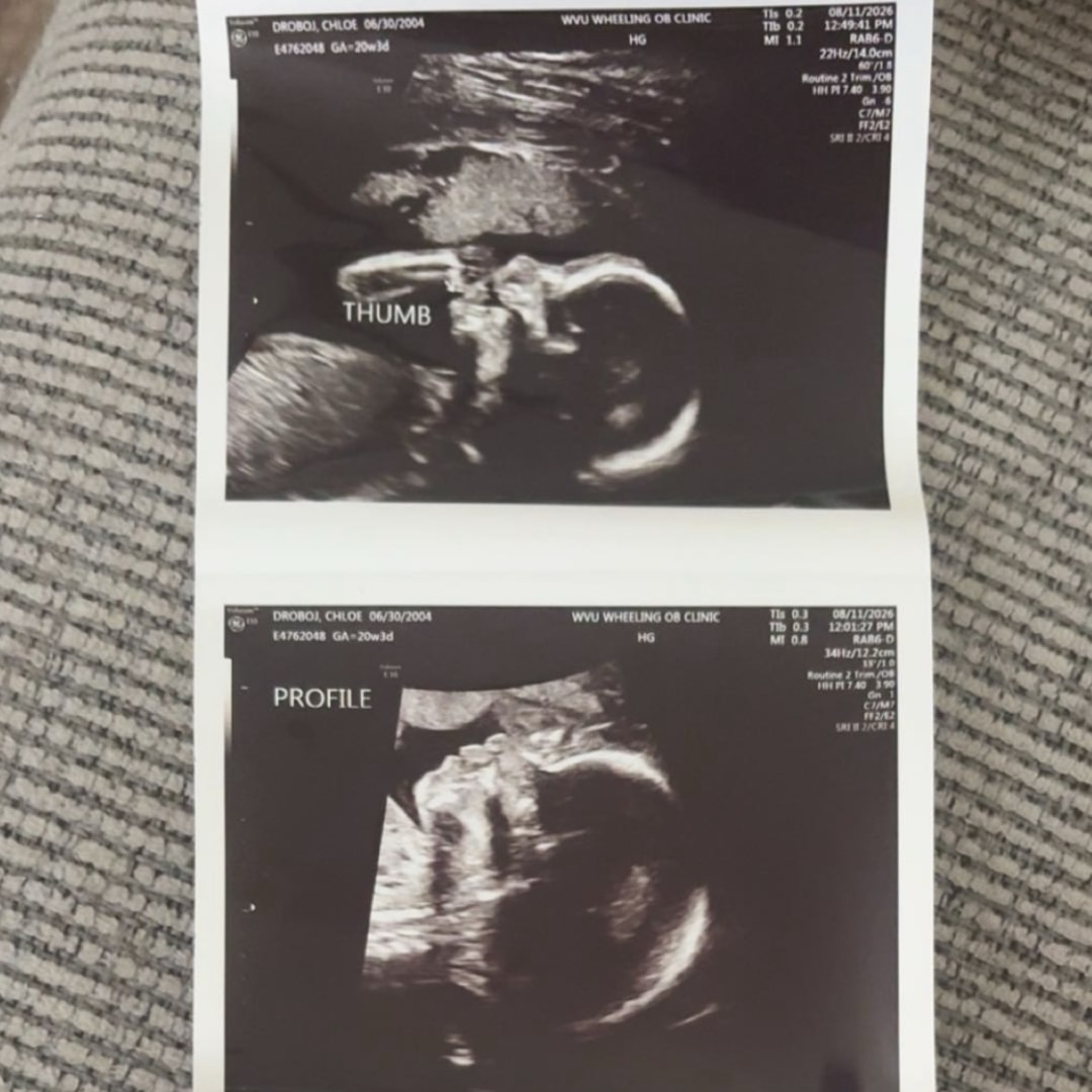 Photo shared by Chloe for their Babylist baby registry.