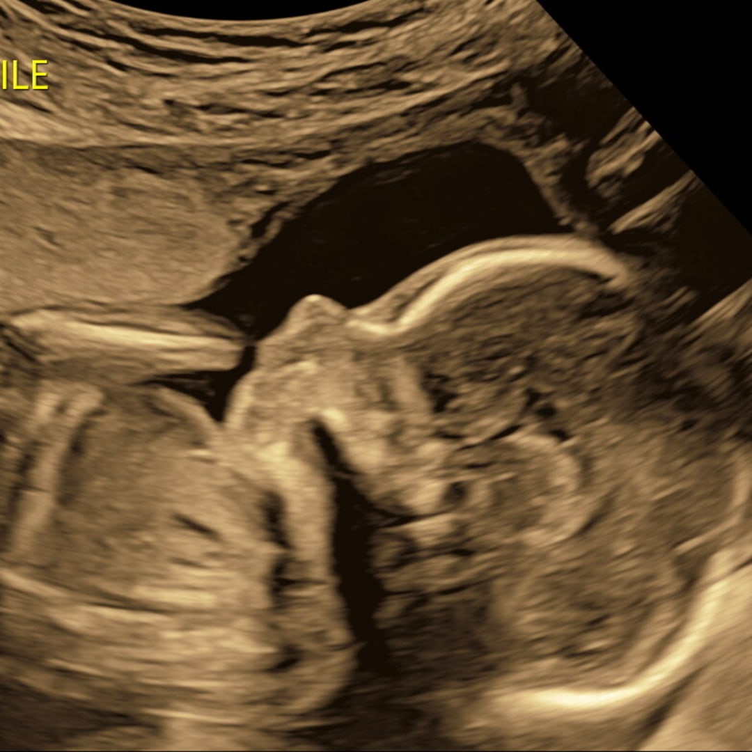 Photo shared by Tyffany for their Babylist baby registry.
