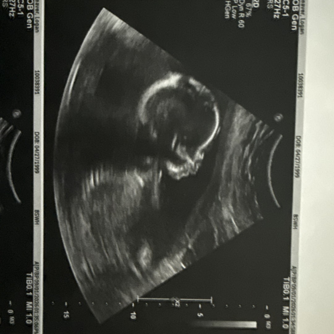 Photo shared by Logan for their Babylist baby registry.