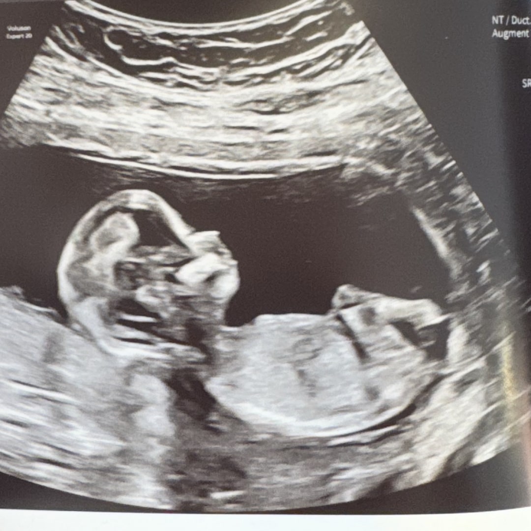 Photo shared by Alyssa for their Babylist baby registry.