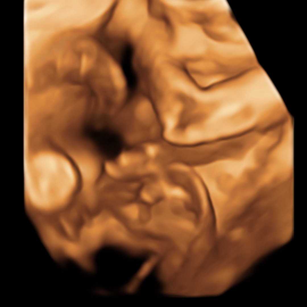 Photo shared by Jessica & Ceasar for their Babylist baby registry.