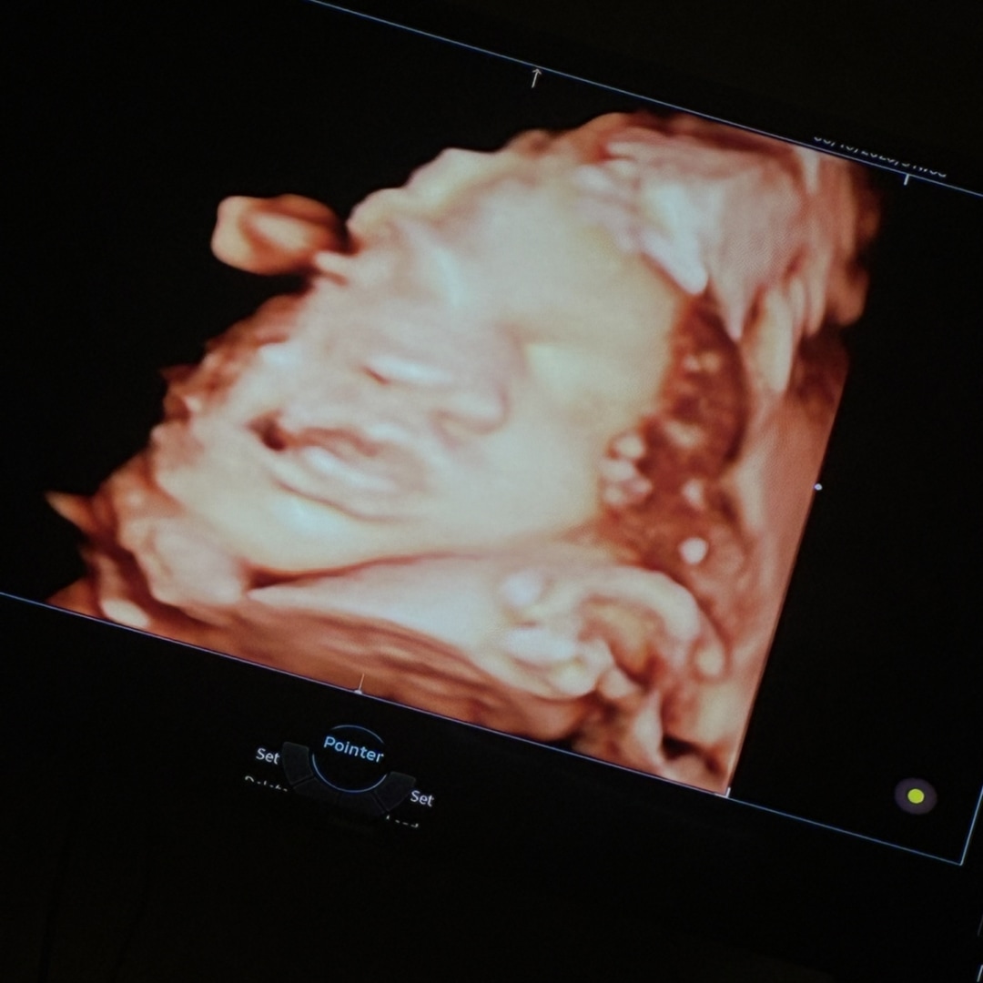 Photo shared by Malaysia for their Babylist baby registry.