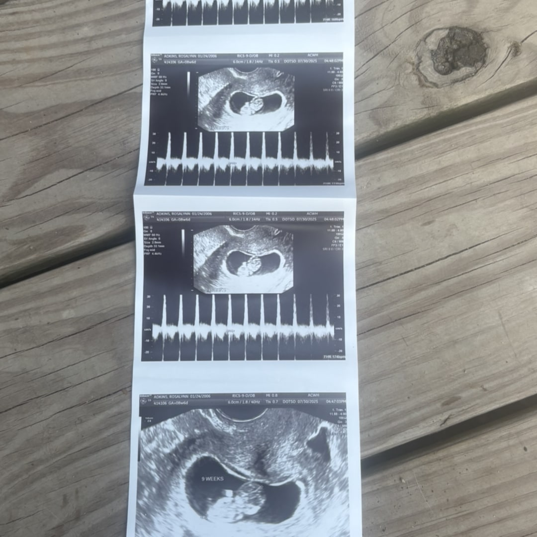 Photo shared by Rosie for their Babylist baby registry.