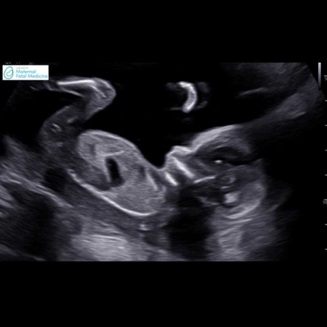 Photo shared by Kailey for their Babylist baby registry.