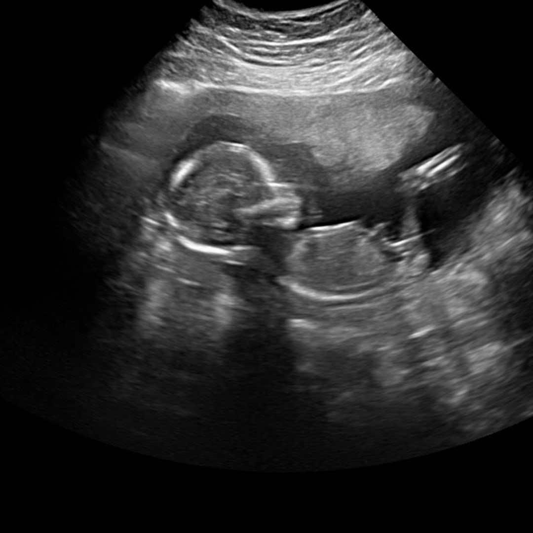 Photo shared by Hamed for their Babylist baby registry.