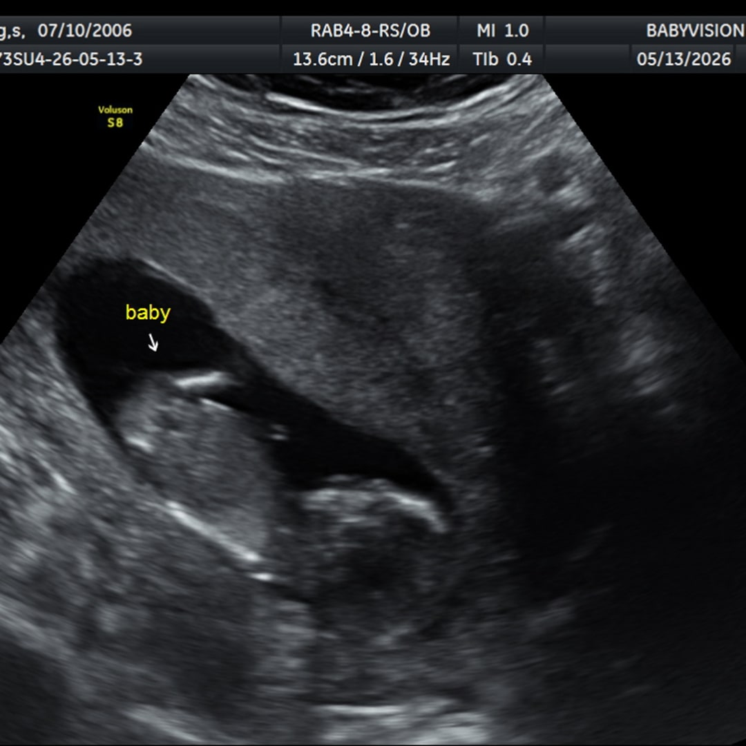 Photo shared by Serenity for their Babylist baby registry.