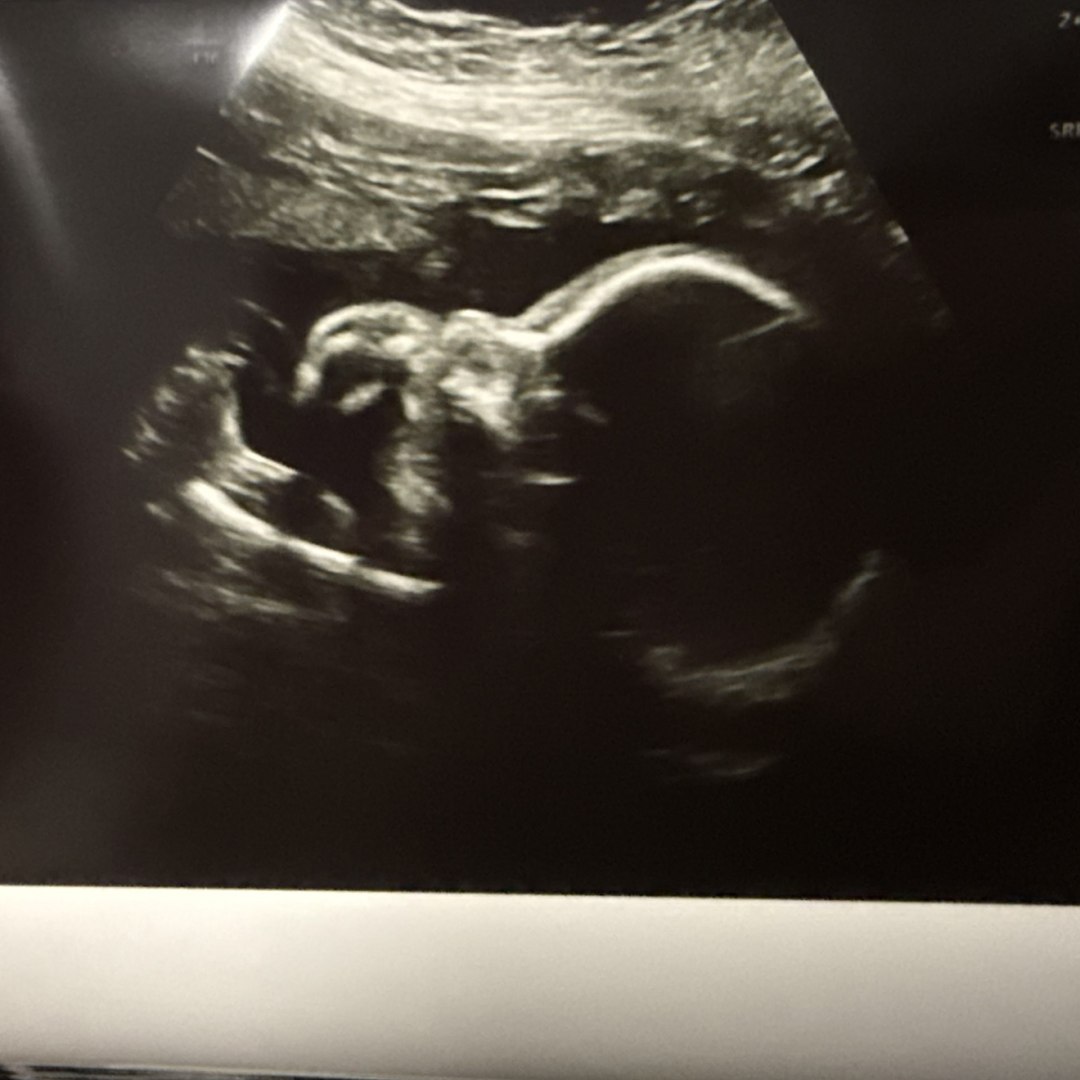 Photo shared by Jenna for their Babylist baby registry.