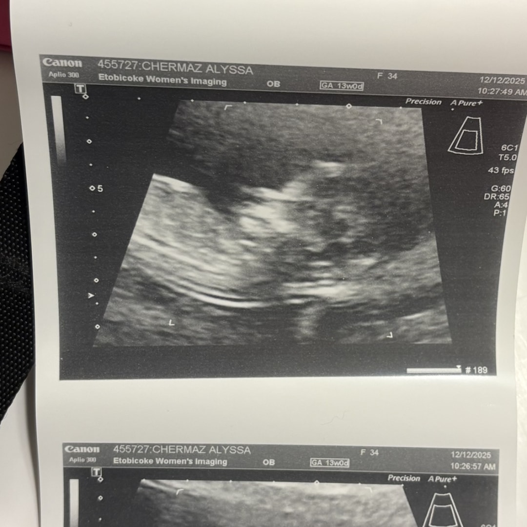 Photo shared by Alyssa for their Babylist baby registry.