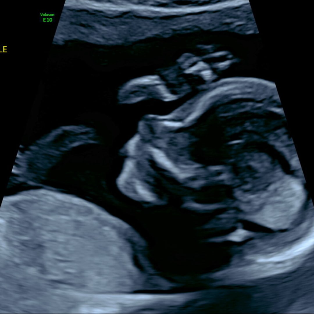 Photo shared by Amber for their Babylist baby registry.