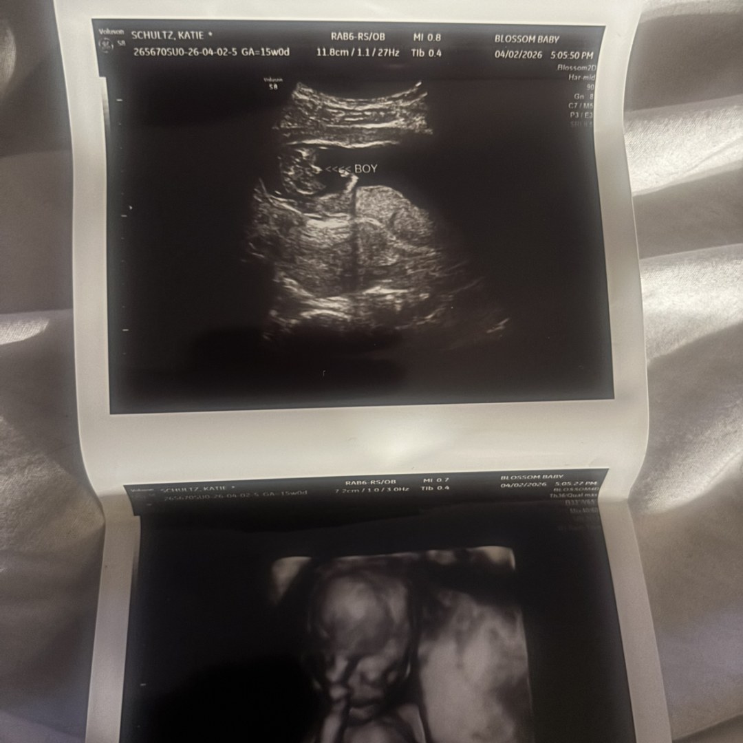 Photo shared by Katie for their Babylist baby registry.