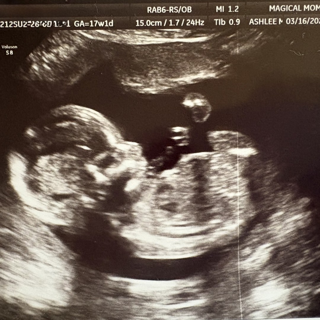 Photo shared by Hannah for their Babylist baby registry.