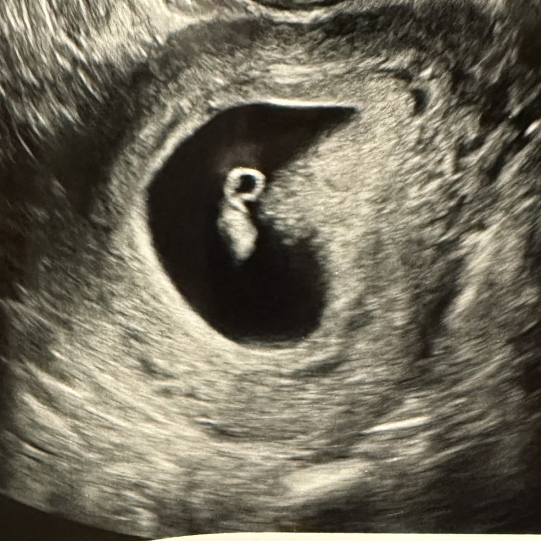 Photo shared by Nadia for their Babylist baby registry.