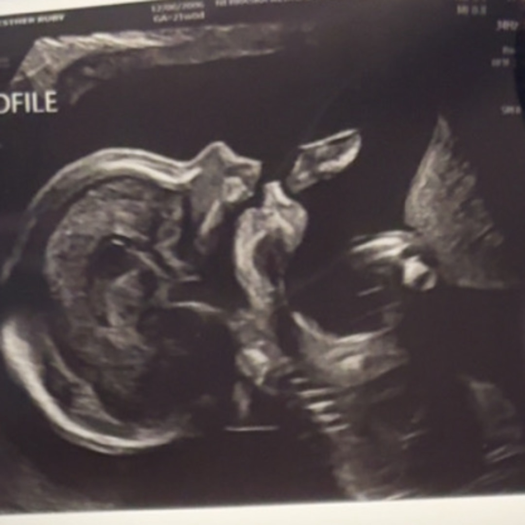 Photo shared by Esther for their Babylist baby registry.