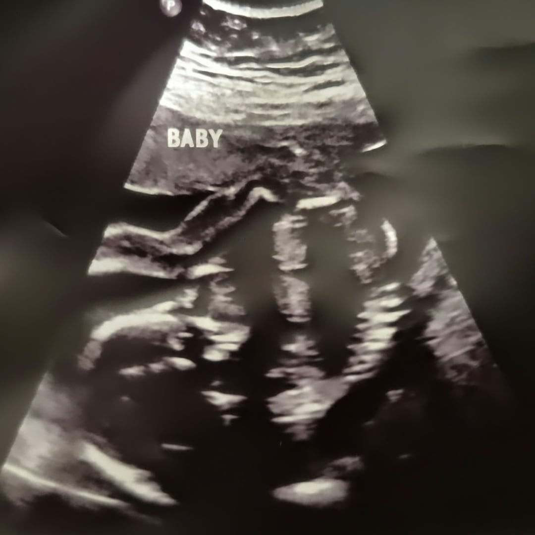 Photo shared by Nicci for their Babylist baby registry.