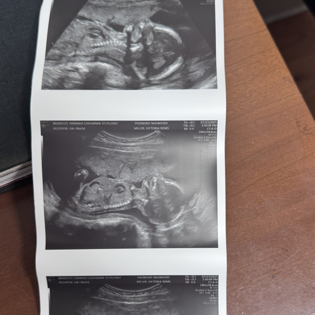 Photo shared by Hannah for their Babylist baby registry.