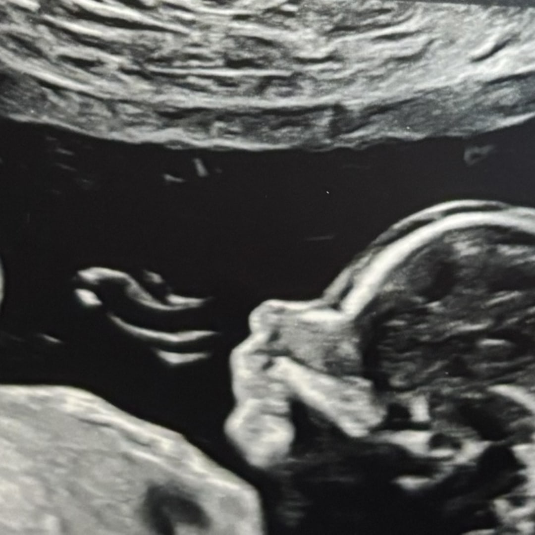 Photo shared by Hannah & Garret for their Babylist baby registry.