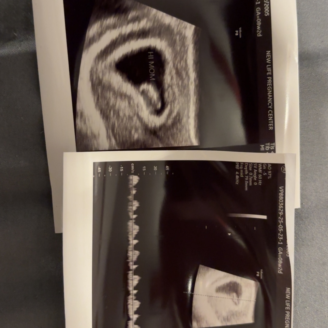 Photo shared by Kaylee for their Babylist baby registry.