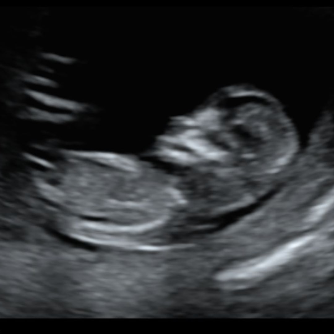 Photo shared by Aalycia for their Babylist baby registry.
