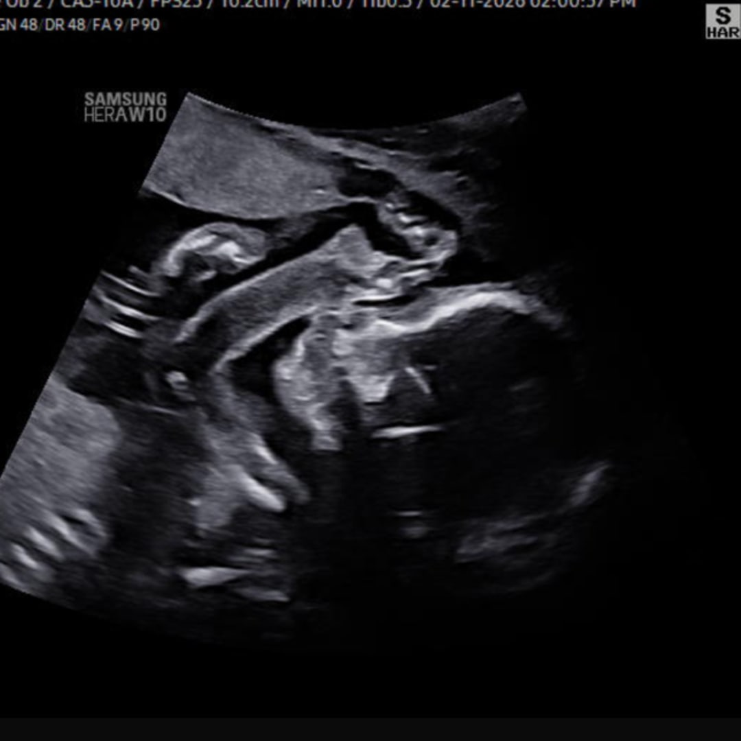 Photo shared by Alexis for their Babylist baby registry.