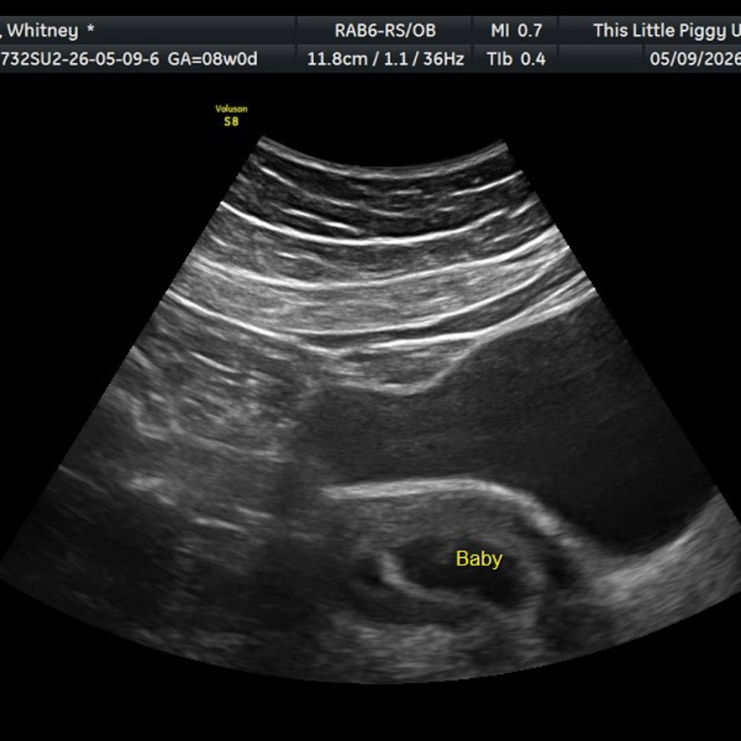Photo shared by Whitney for their Babylist baby registry.