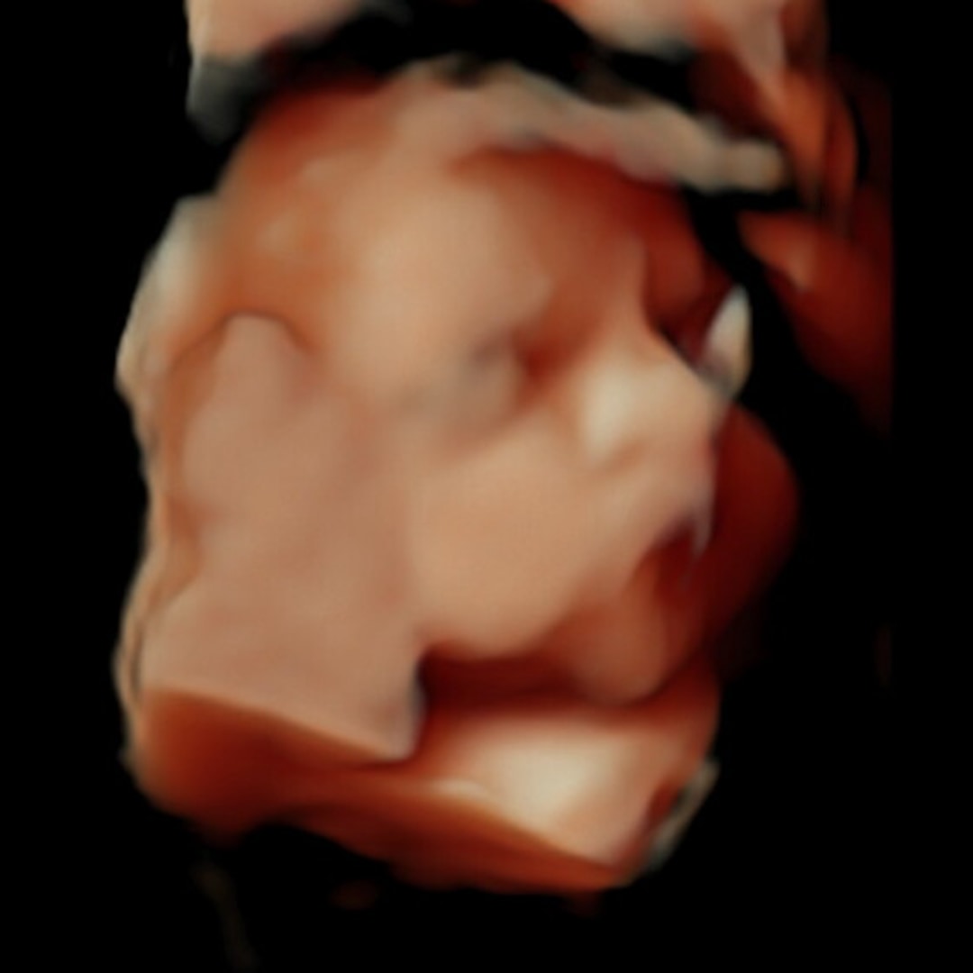 Photo shared by Riley for their Babylist baby registry.