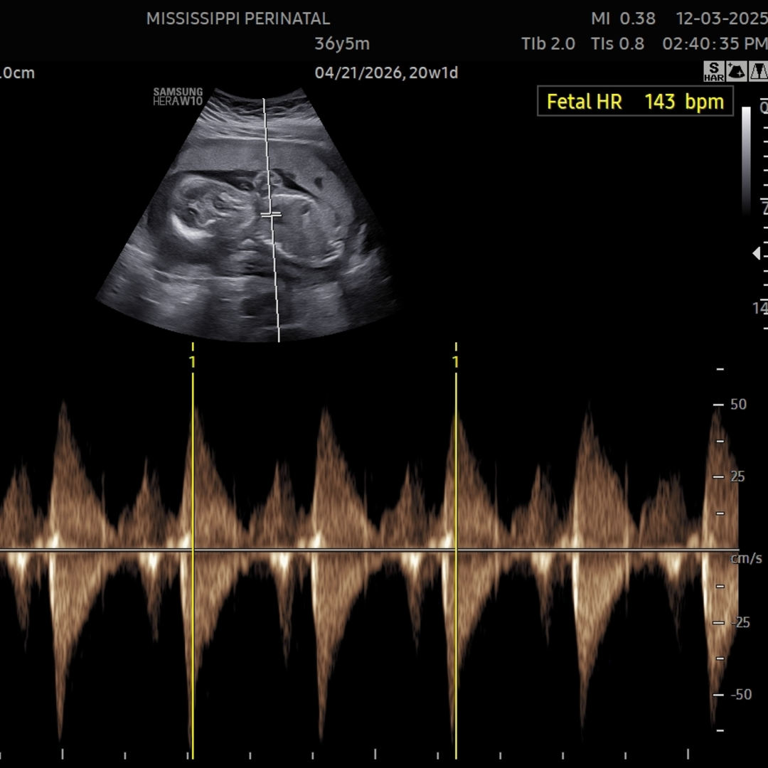 Photo shared by Taylor for their Babylist baby registry.