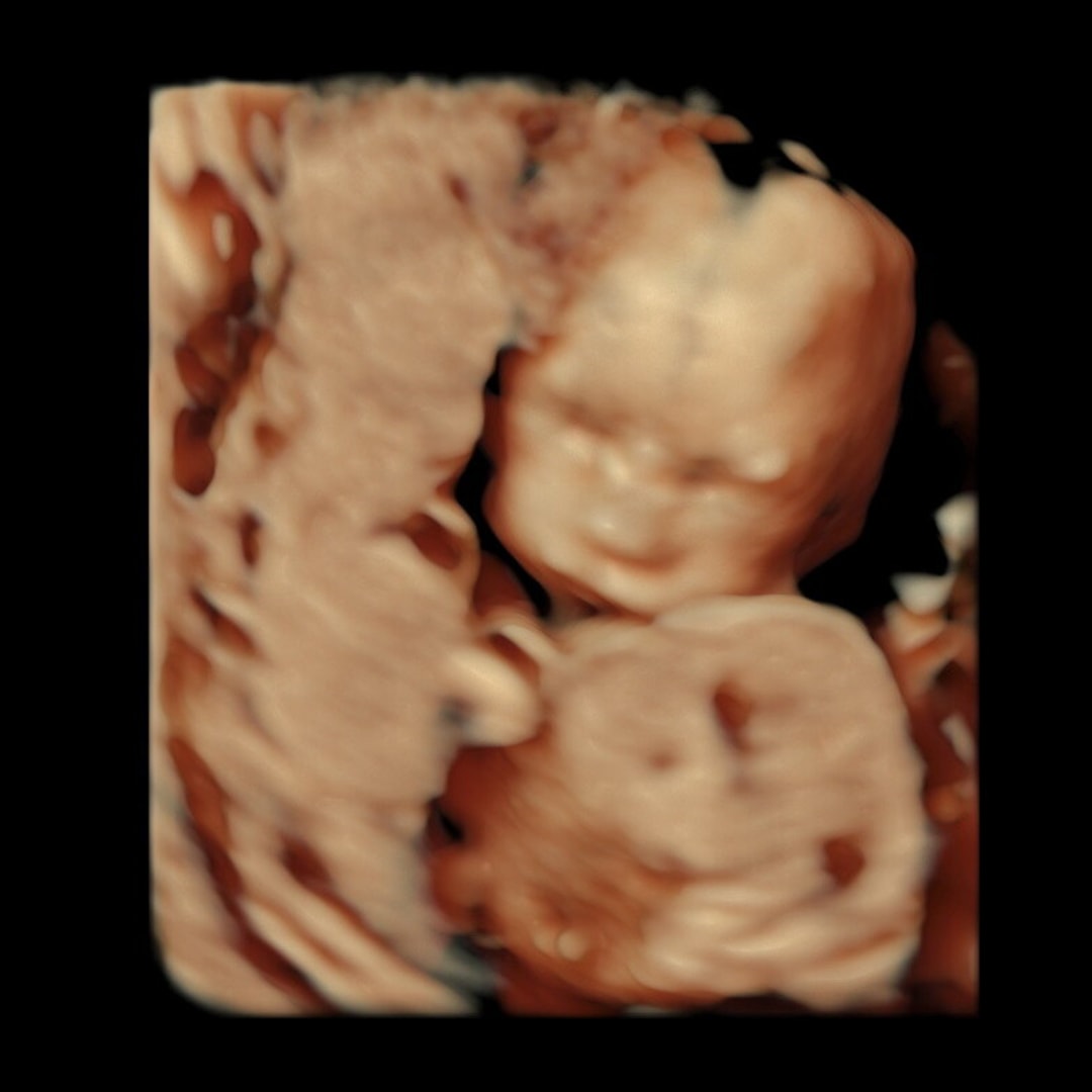 Photo shared by Delaney for their Babylist baby registry.