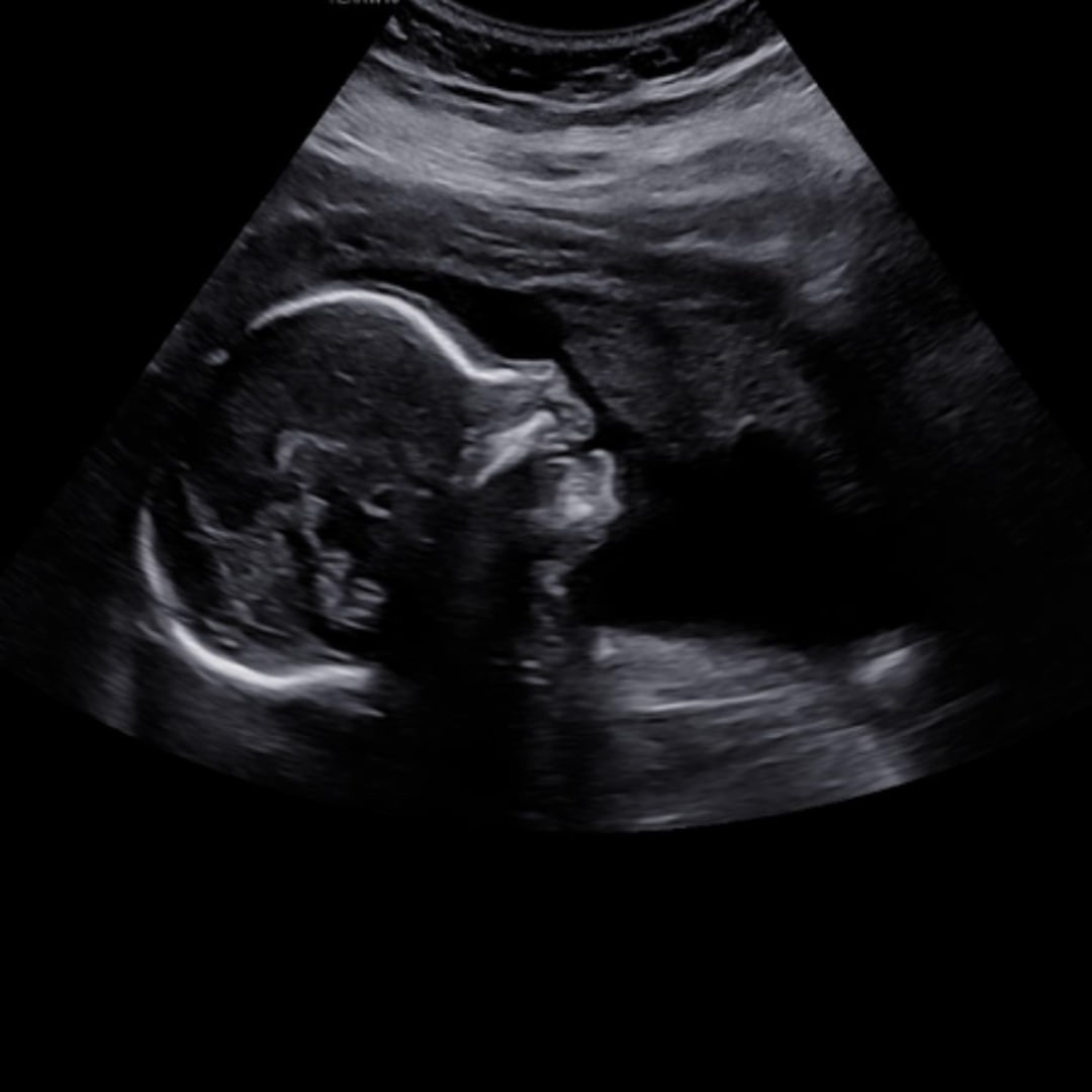 Photo shared by Dominique for their Babylist baby registry.