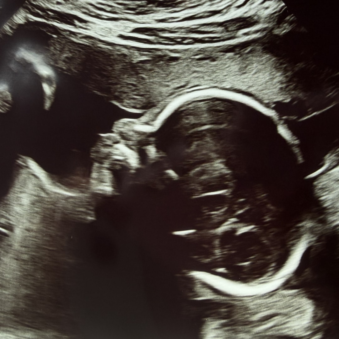 Photo shared by Mallory for their Babylist baby registry.