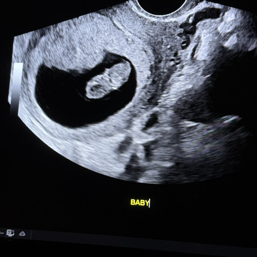 Photo shared by Keri for their Babylist baby registry.