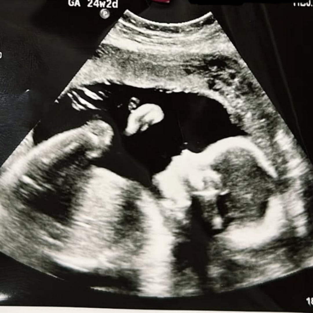 Photo shared by Chavely for their Babylist baby registry.