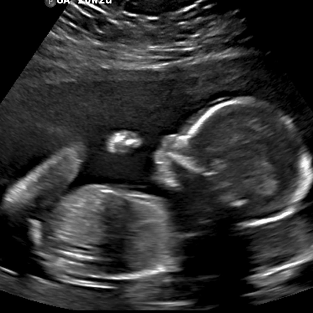 Photo shared by Angela for their Babylist baby registry.