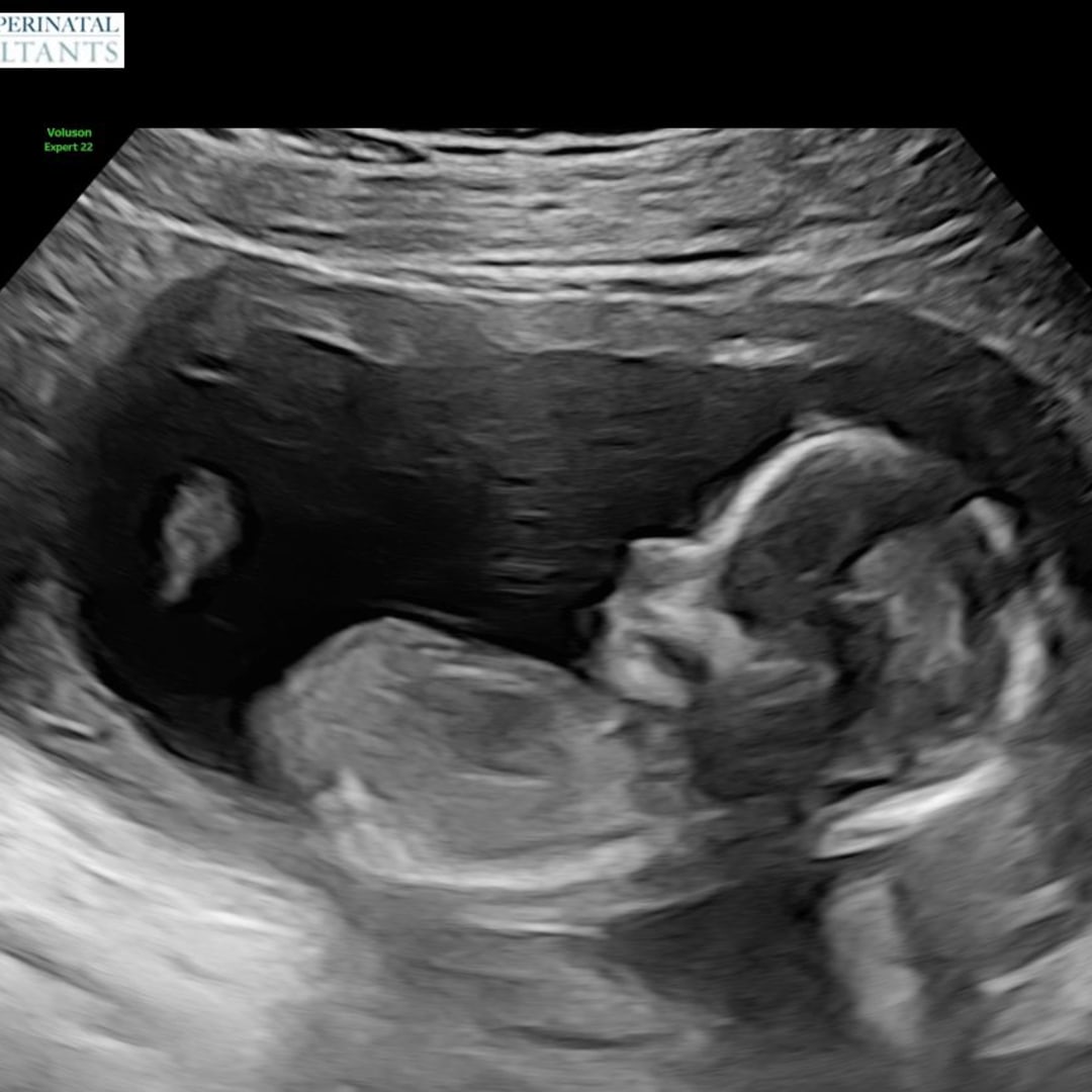 Photo shared by Jennilee for their Babylist baby registry.