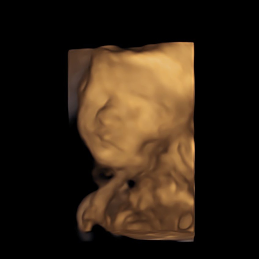 Photo shared by Taylor for their Babylist baby registry.