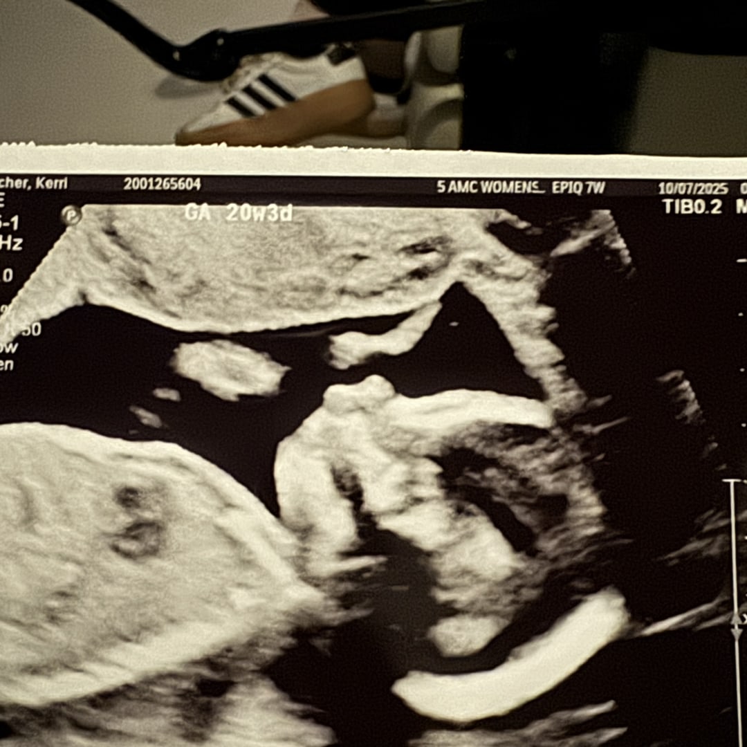 Photo shared by Kerri for their Babylist baby registry.