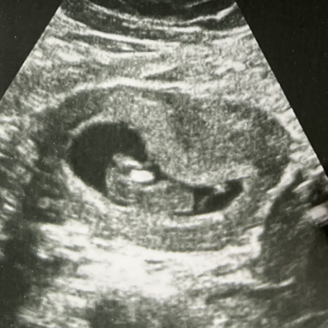 Photo shared by Alejandra for their Babylist baby registry.