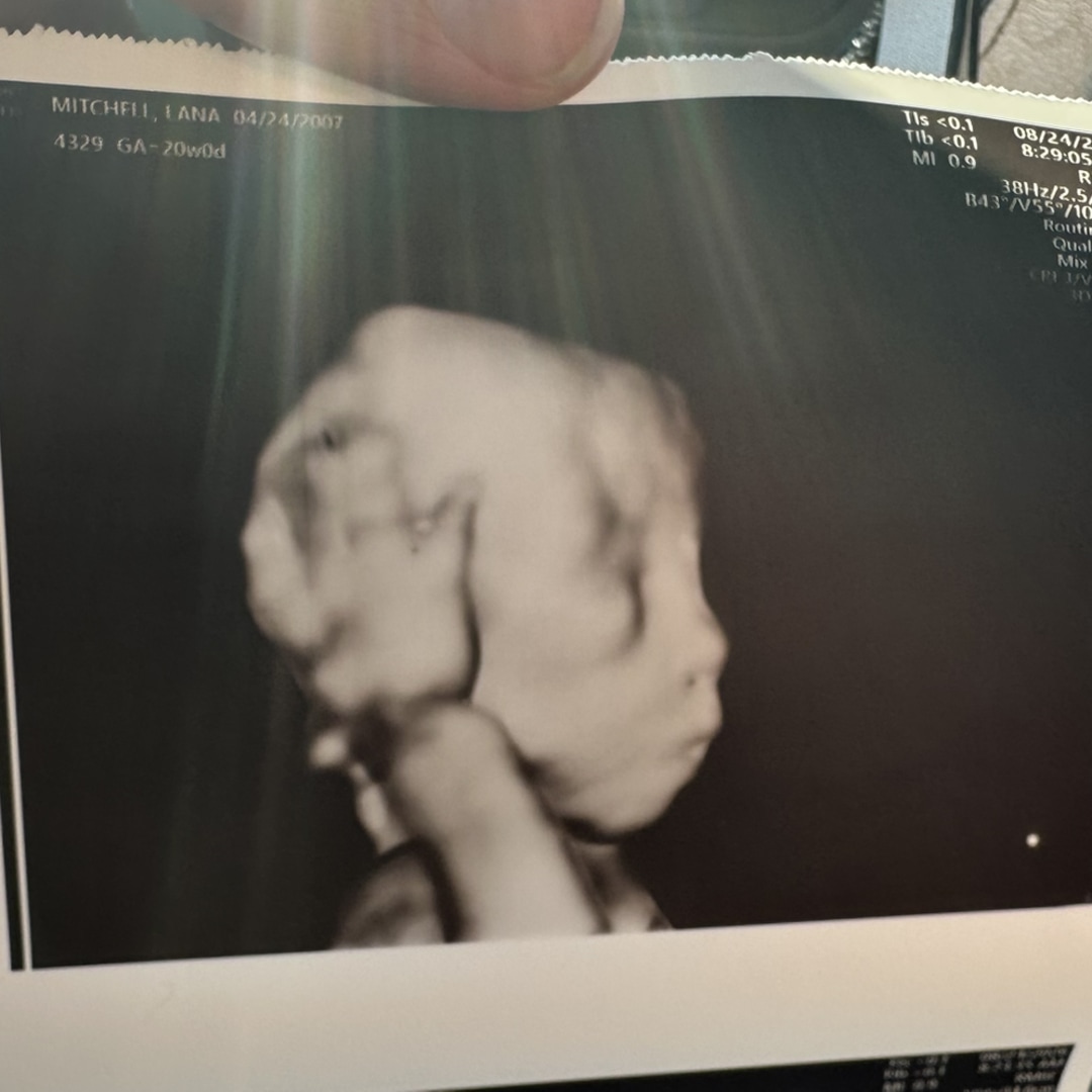 Photo shared by Lana for their Babylist baby registry.