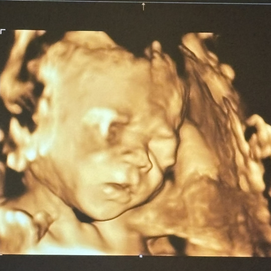 Photo shared by Chy for their Babylist baby registry.