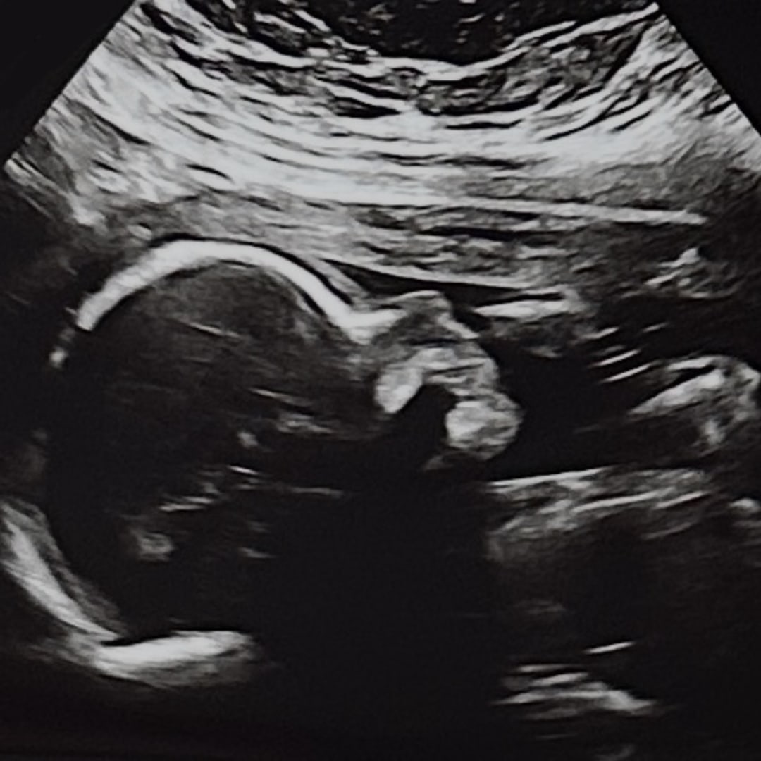 Photo shared by Elyza for their Babylist baby registry.